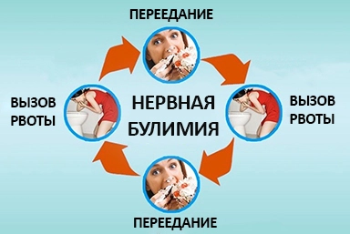 Лечение булимии в Заинске